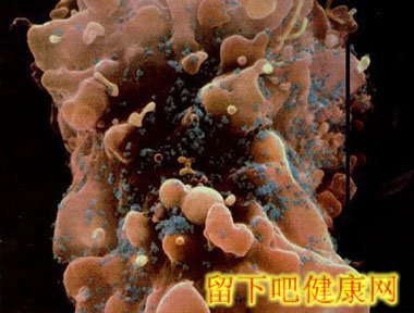 生殖器疱疹的症状及治疗