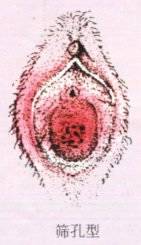 141×245