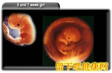 刚成形的胎儿和二周的女婴