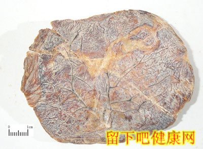 倒卖人体胎盘  触目惊心的黑幕
