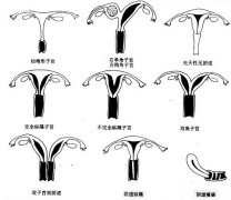 Ρӹʾͼ