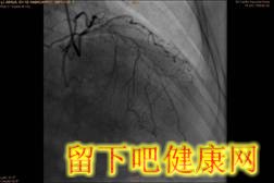 糖尿