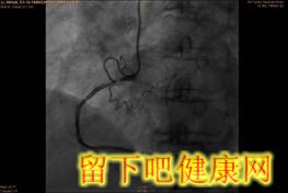 糖尿