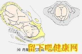 胎儿如何经过产道？