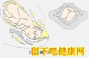 胎儿如何经过产道？
