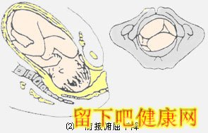 胎儿如何经过产道？