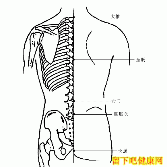 腰椎间盘突出症的锻炼方法