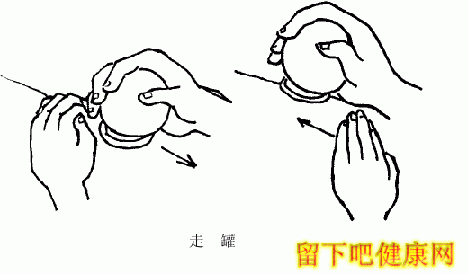 腰椎间盘突出症的治疗方法